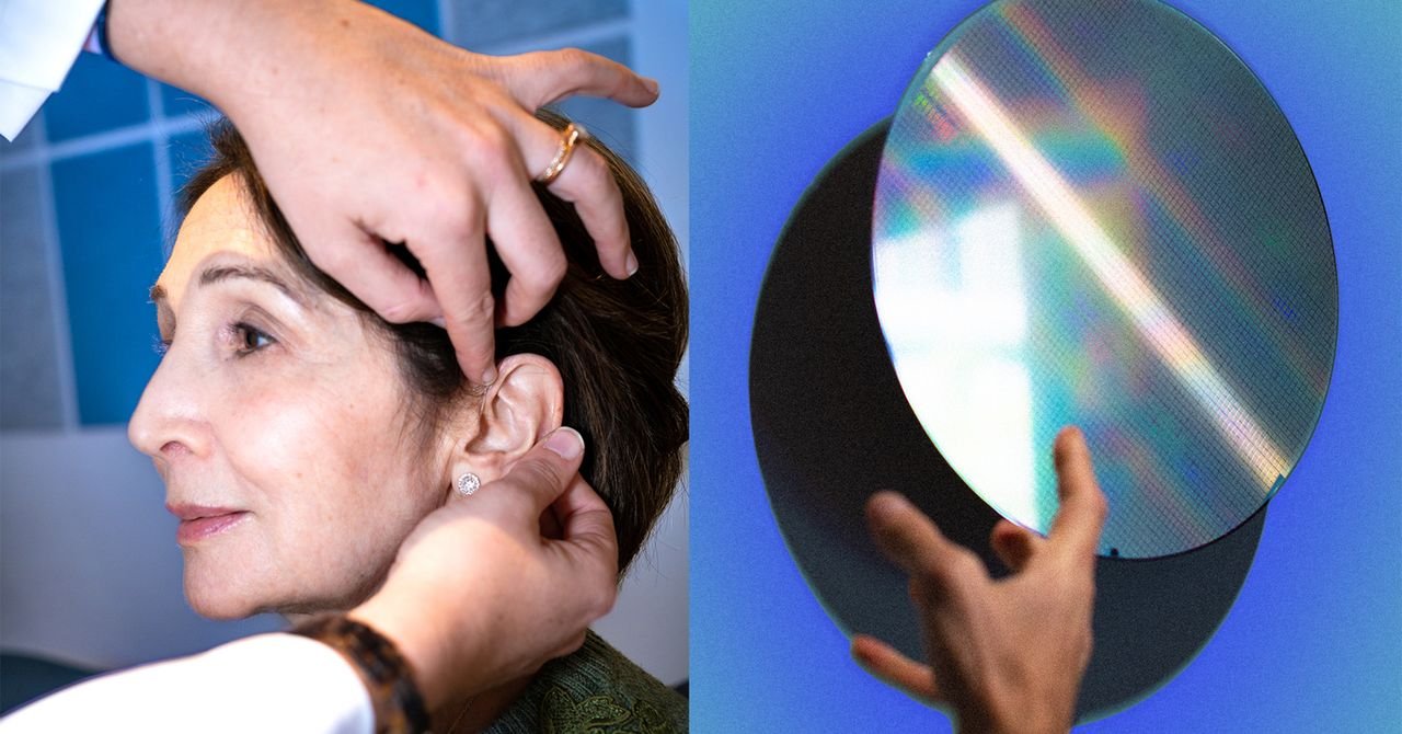 Quer um aparelho auditivo Fortell? Bem, quem você conhece?