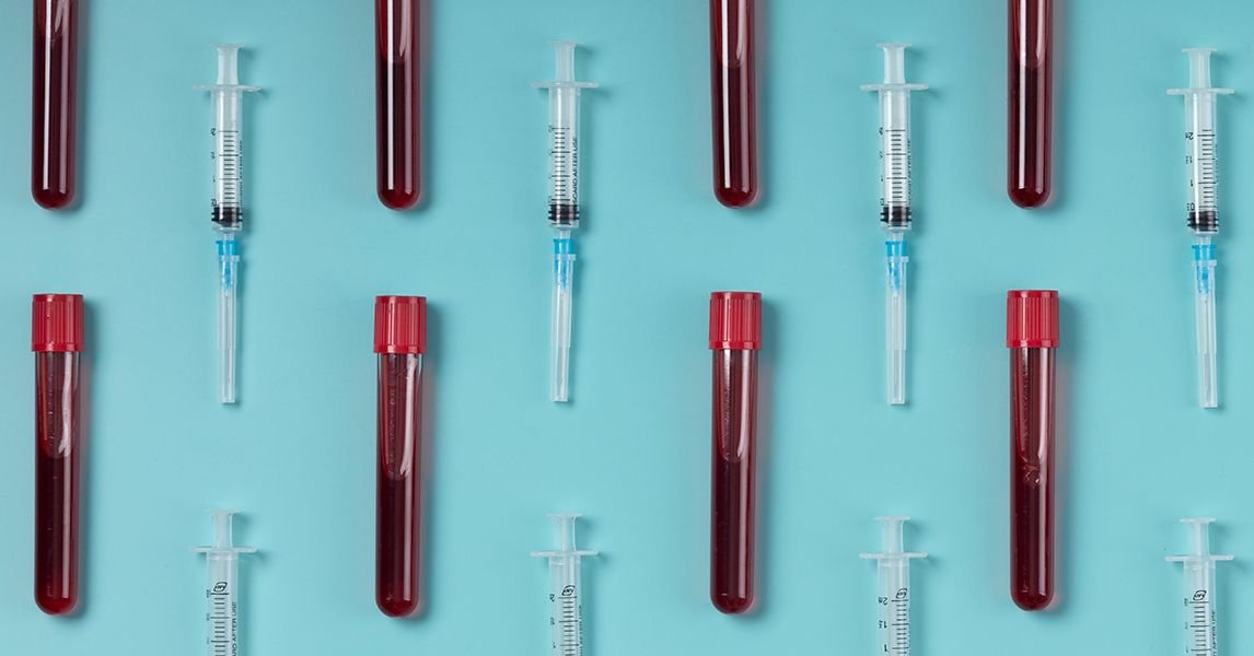 Blood Feud: painéis de saúde de Oura versus laboratórios avançados de Whoop