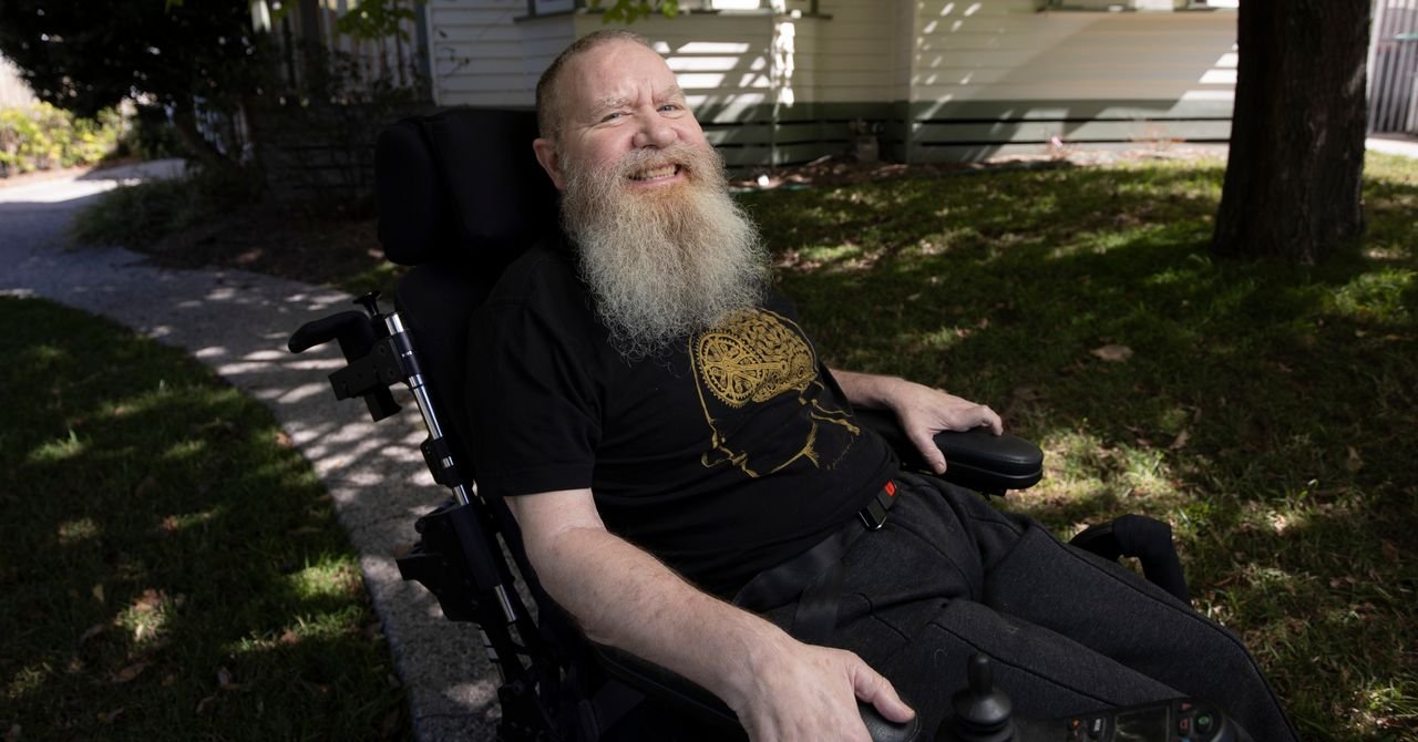 Como é ter um implante cerebral por 5 anos