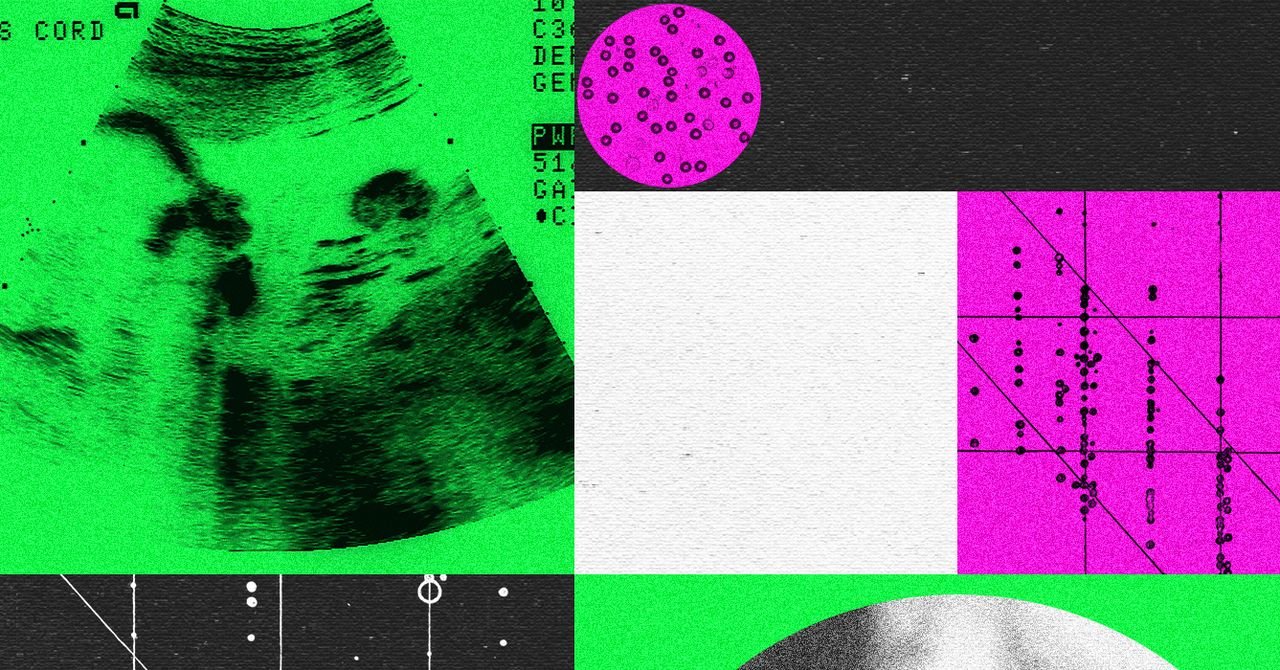 Empresas de designers de bebês estão em crise